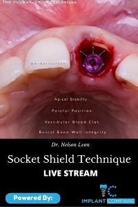 Socket Shield Technique by Dr. Nelson Leon Logo